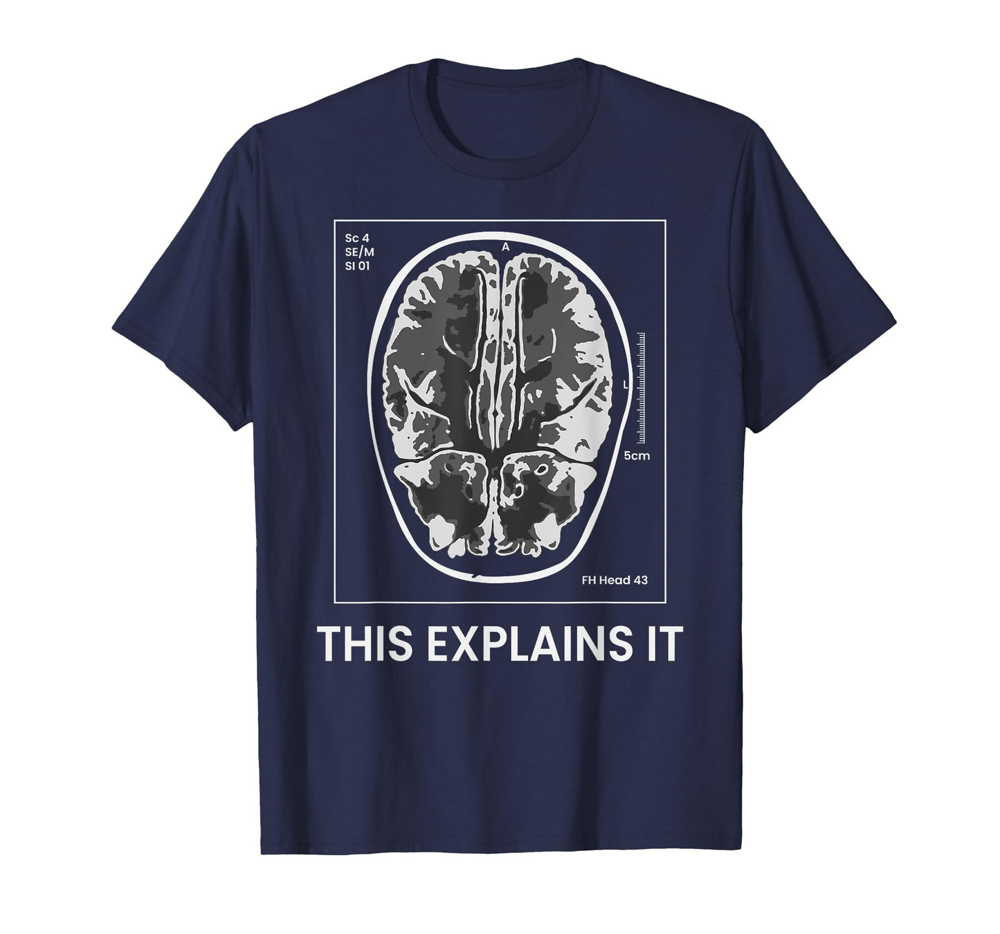 Funny MRI Scan Brain for CRAZY CAT LADY This Explains it T-Shirt