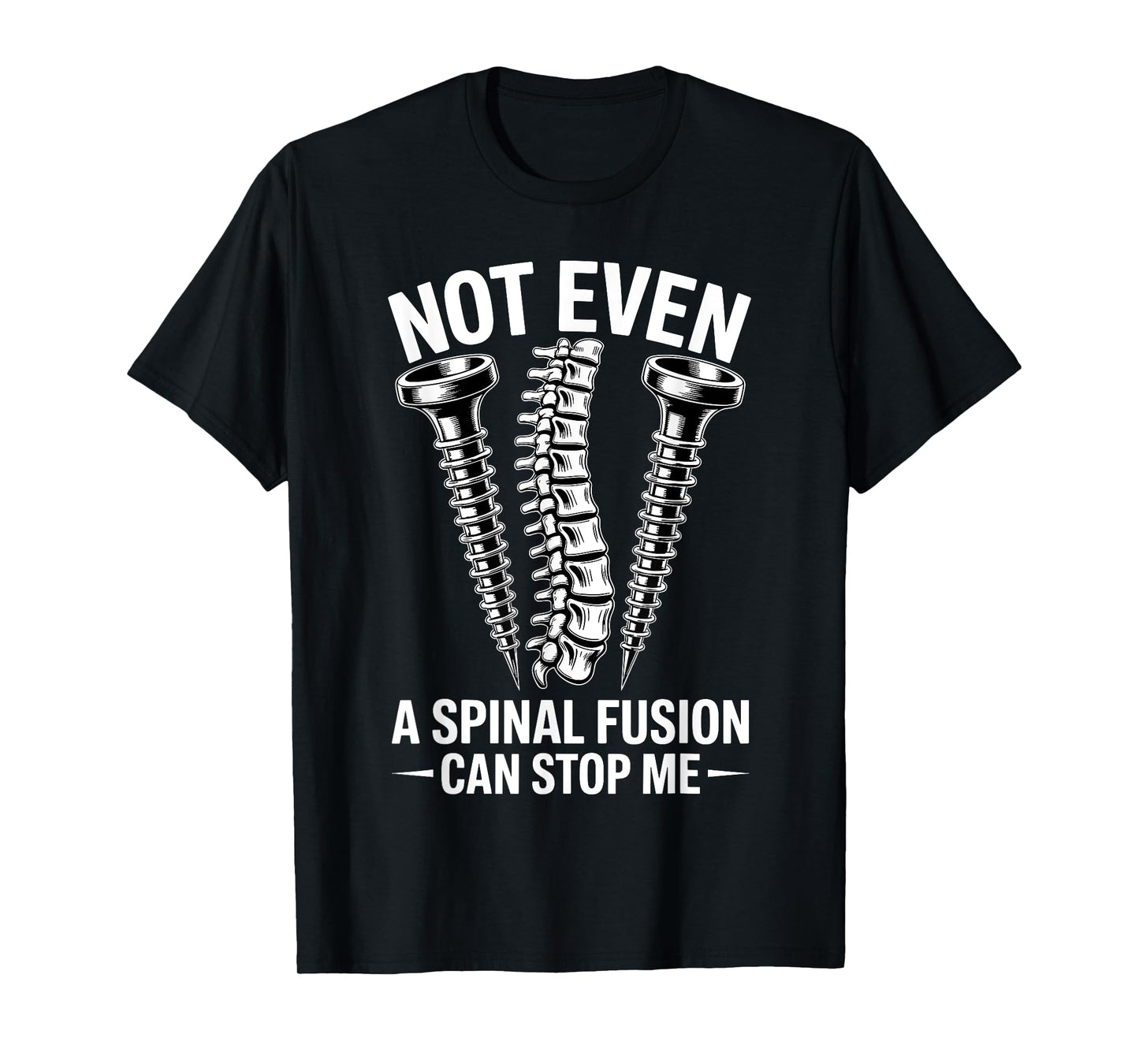 Funny Spinal Fusion Art For Men Women Kids Spine Surgery T-Shirt