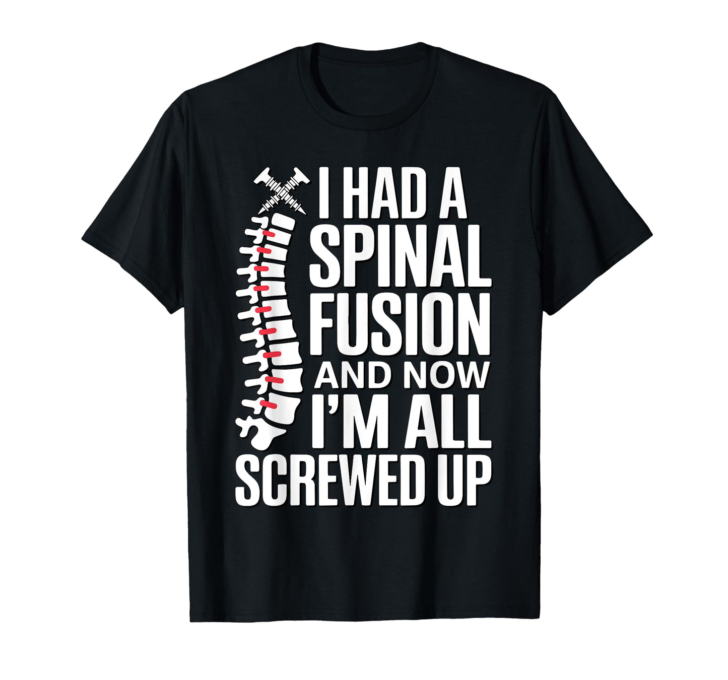 Funny Spinal Fusion Art for Men Women Kids Spine Surgery T-Shirt
